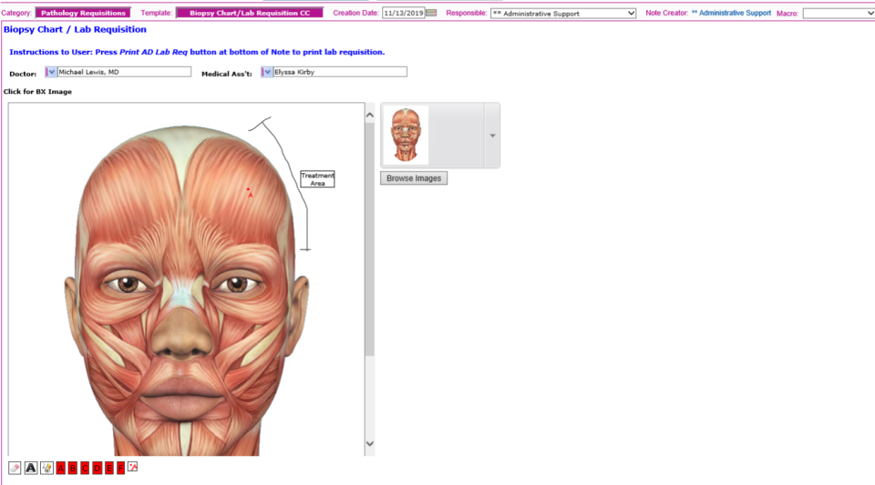 screenshot of MD Charts